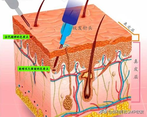 纹发真实效果（一篇图文让你快速了解什么是纹发）(3)