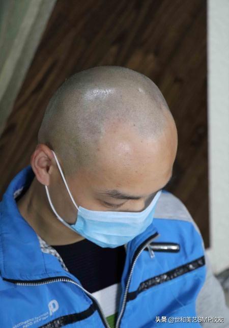 纹发真实效果（一篇图文让你快速了解什么是纹发）(8)