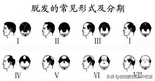 纹发真实效果（一篇图文让你快速了解什么是纹发）(4)