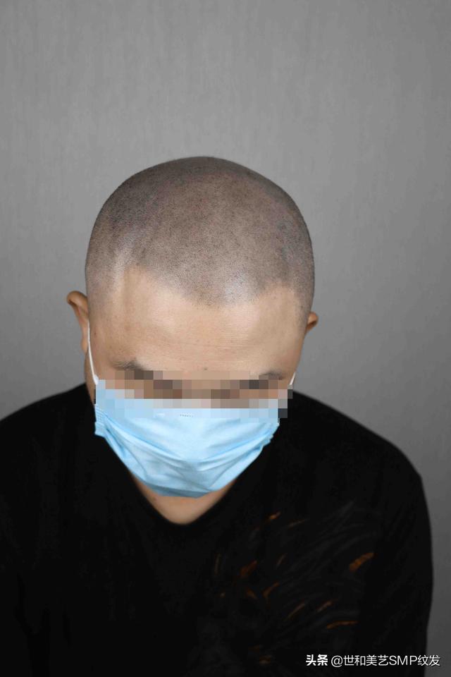 纹发真实效果（一篇图文让你快速了解什么是纹发）(10)