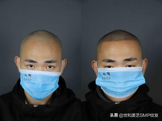 纹发真实效果（一篇图文让你快速了解什么是纹发）(5)