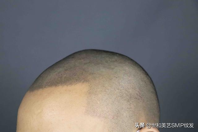 纹发真实效果（一篇图文让你快速了解什么是纹发）(6)