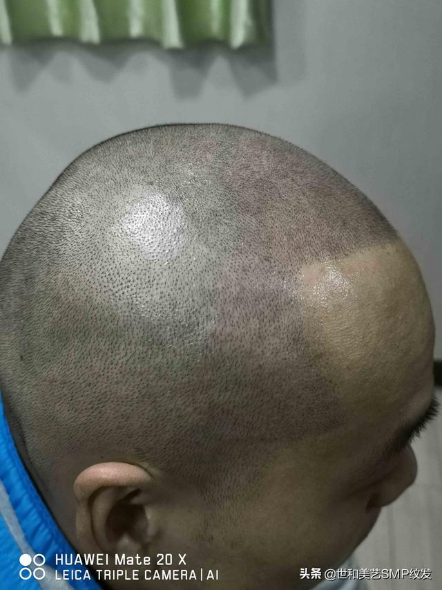 纹发真实效果（一篇图文让你快速了解什么是纹发）(9)