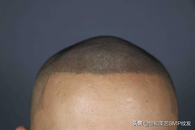 纹发真实效果（一篇图文让你快速了解什么是纹发）(7)