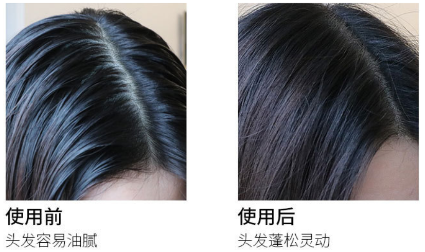 生姜洗发水怎么样(洗姜力洗发水效果好吗)-图10